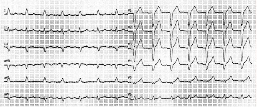 Kasuistik Amedeo November.png