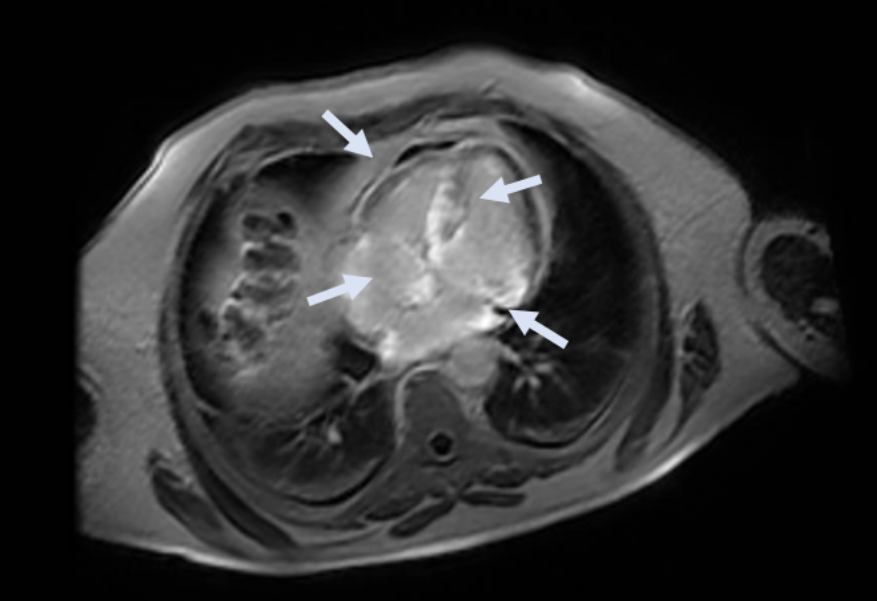 Kasuistik Amedeo November 2.png