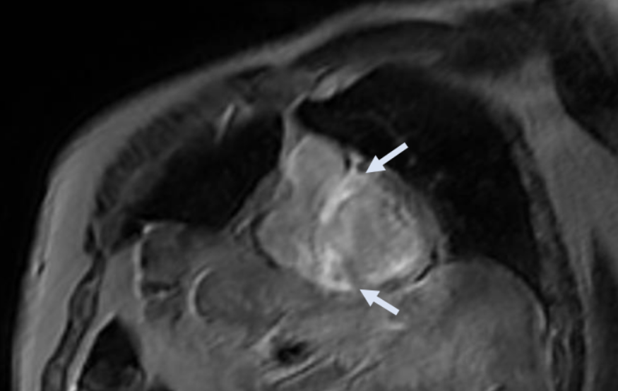 Kasuistik Amedeo November 3.png