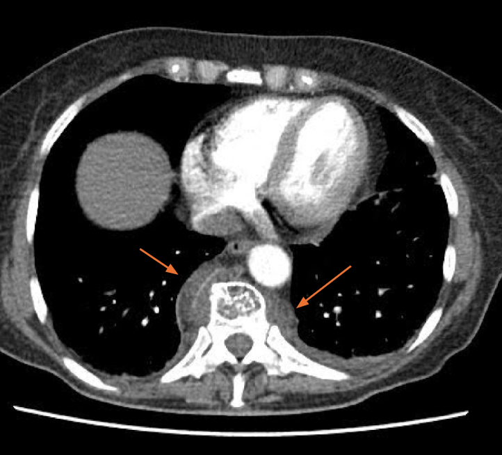 Kasuistik Aymen Meddeb.png