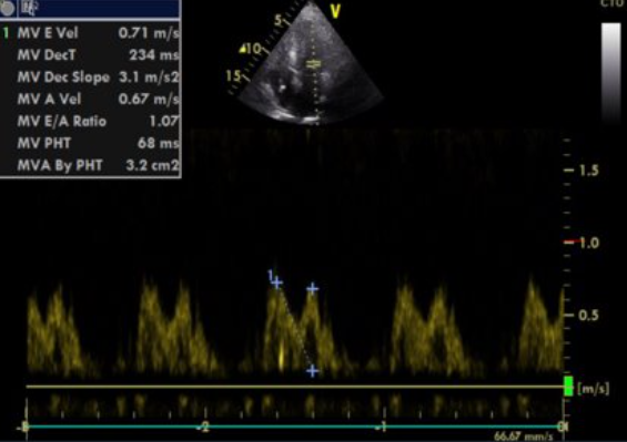 Kasuistik Amedeo November 1.png