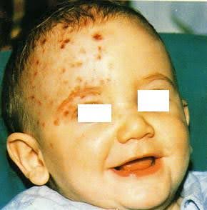 Befund Hautausschlag .jpg