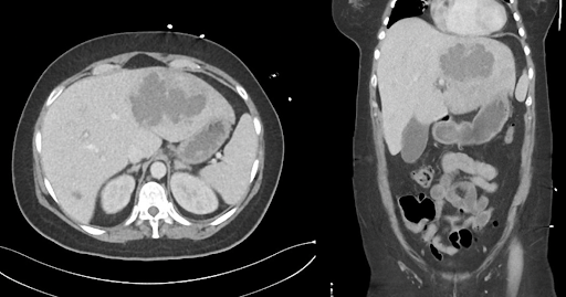 Tropenmedizinischer Notfall.png